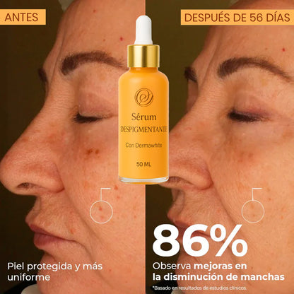 Sérum Despigmentante Facial Dermawhite SECRETOS – Elimina Manchas en 2 Semanas, Aclara e Ilumina la Piel