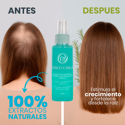 Tónico Capilar SECRETOS | Frena Caída y Revive Tu Melena 💧